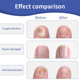 Nail Repair Solution - Gentle Treatment for Healthy Nails