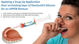 DENSUREFIT Upper Denture Reline Kit