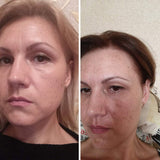 Luxury Swiss Dark Spot Remover for Face Body Serum Age Sun Brown Spot Freckles Corrector Melasma treatment Anti aging Skin Vitamin C + Niacinamide organic Magiclear