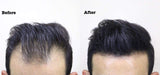 THICK FIBER Hair Fibers for Thinning Hair & Bald Spots (BLACK) - 25g Bottle - Conceals Hair Loss in Seconds - Hair Powder for Women & Men