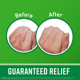 O'Keeffe's Working Hands Hand Cream, Relieves and Repairs Extremely Dry Hands, 3 oz Tube, (Pack of 5)