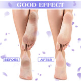 Tarpop 3 Pairs Aloe Socks Moisturizing Spa Socks for Dry Cracked Feet Infused Socks Gel Sleeping Fuzzy Socks Lotion Socks Gift for Christmas Women Men Softening Dry Feet(Purple and White)