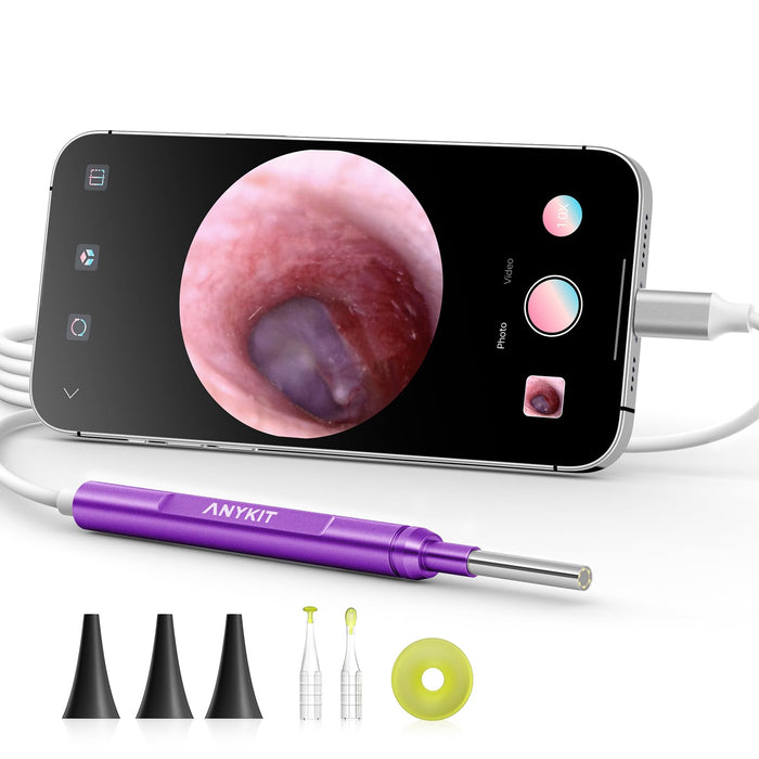 Anykit Digital Otoscope for Phone & Tablet, Ultra Clear View Ear Camera with Ear Wax Removal Tools, Video Ear Scope Otoscope with Light, Support Capture Photo & Record Videos