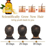 5 Pack Hair Growth Serum,Ginger Biotin Hair Regrowth Serum Prevent Hair Loss and Natural Serum for Thicker, Stronger, Longer Hair Men and Women