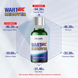 Dr. Luke Genital Wart Liquid for Men & Women Fast, Exclusive Formula Wart Products for Genital Wart, Common Wart, Filiform Wart, Flat Wart, and Tiny Wart-30 ml