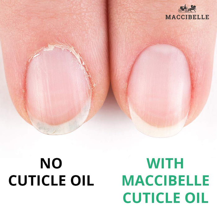 Maccibelle Cuticle Oil Heals Dry Cracked Cuticles 0.5 oz 2 Bottles (Lemon)