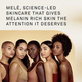 Mele Even Dark Spot Visibly Reduces Dark Spots, Uneven Tone, And Signs Of Aging Control Serum With Niacinamide, Vitamin E, And Pro-Retinol 1 oz (Pack of 4)
