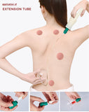 ACEBON Cupping Set, Cupping Therapy Sets Massage Back, Pain Relief, Physical Therapy, Chinese Cupping kit with Vacuum Pump