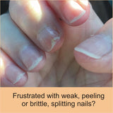 FlexiNail Penetrating Fingernail Conditioner and Strengthener to repair and then maintain weak and peeling or brittle and splitting nails