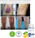 Purpurex - The Leading Supplement for Age-Related Bruising (30-Day Supply)