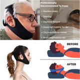 Veralabs Airflow Jaw Strap, 2024 New Veralabs Airflow Jaw Strap, Air Flow Jaw Strap for Women Men, Vera Labs Airflow Jaw Strap, Airflow Jaw Strap for Sleep Apnea Veralabs (Blue,2PC)