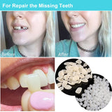 Brige Tooth Repair kit for Filling The Missing Broken Tooth and Gaps-Moldable Fake Teeth and Thermal Beads Replacement Kit