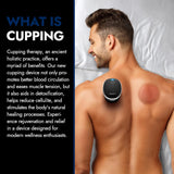 serapy Smart Cupping Device for Pain Relief, Portable Electric Cupping Therapy Massager for Aches and Muscle Soreness, Boost Circulation, Dynamic Sunction, Black