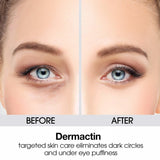 Dermactin-TS Upper Eyelid Cream 1 oz. Firms & Tones Sagging & Drooping Skin On Upper Eye Lids, for Younger, More Vibrant & Alert Appearance, for Sensitive Skin In The Eyelids
