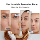 Niacinamide 10% + Zinc 1% Serum for Face, 30ML/1 Fl Oz Anti-aging Niacinamide Serum for Women, 2 PCS Niacinamide Facial Serum For Acne.