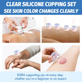 ELERA Silicone Cupping Therapy Set, Professionally Chinese Massage Cups for Cupping Therapy and Cellulite Reduction (7 Cups)