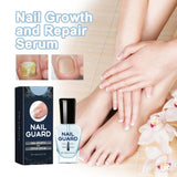 Onyxoguard Nail Growth And Repair Serum, 1/2/3 Pcs Onyx Guard Nail, Onyxoguard Serum, Nail Strengthener For Thin Nails And Growth,Revitalize And Strengthen Your Nails (2 Pcs)