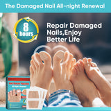 Toenail Repair Treatment, 16Pcs Nail Repair Treatment Extra Strength, Restores Health Appearance of Discolored or Damaged Nails, Comfortable & Convenient