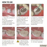 Automix Permanent Dental Cement for Caps, Crown, Bridges, Inlays, Onlays, Implants, Veneers