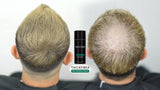 THICK FIBER Hair Building Fibers for Bald Spots & Thinning Hair (LIGHT BROWN) - 25g Bottle - Conceals Hair Loss in Seconds - Hair Fibers for Men & Women