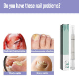 Nail Care Pen, Nail Treatment Pen, Cuticle Oil Pen, Nail Strengthener Repair Serum for Toenail, Nail Repair