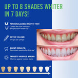 VieBeauti Teeth Whitening Kit - 5X LED Light Tooth Whitener with 35% Carbamide Peroxide, Mouth Trays, Remineralizing Gel and Tray Case - Built-in 10 Minute Timer Restores Your White Smile Mint