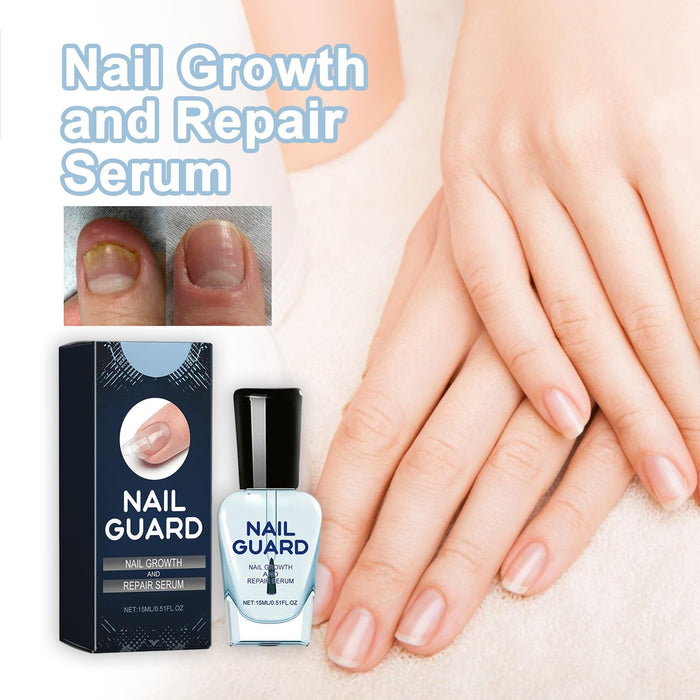 Onyxoguard Nail Growth and Repair Serum, Onyxoguard Nail Growth and Repair Serum 1Pcs (1Pcs)