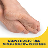 Dr. Scholl's Severe Cracked Heel Repair Restoring Balm 2.5oz, 3 Pack, with 25% Urea for Dry, Cracked Feet, Heals and Moisturizes for Healthy Feet