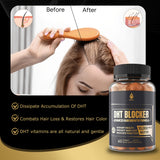 DHT Blocker Gummies Hair Growth Supplement, Super Potency Saw Palmetto & Biotin 10000 mcg for Women & Men, Plus 12 Proprietary Blend - Prevent Hair Loss, Blocking DHT Receptors, Hormonal Balance