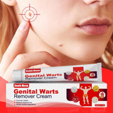 Gentle Skin Treatment for Warts - Freeze Off Cream for Effective Wart Care