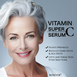 Vitamin Super C Serum for Women over 70, Rapid Anti Aging Serum, Hydrates, Softens, Lifts and Firms Super C Serum (30ml-1pcs)