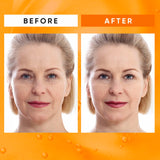 Super Vitamin C Serum for Women Over 70: Hyaluronic Acid Face Serum for Facial Use Dark Spot Anti Aging Suitable Mature Skin - Targets Age Marks Wrinkles and Smooths Skin Texture