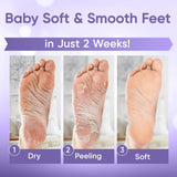 Foot Peel Mask (5 Pairs) - Foot Mask for Baby Soft Skin - Remove Dead Skin, Dry, Cracked Feet & Callus, Foot Spa, Made with Aloe Vera Extract for Women and Men Feet Peeling Mask Exfoliating, Lavender