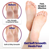 Moisturizing Socks for Men | Cracked Heel Treatment with Aloe Vera | Moisturizer Foot Callus Remover | Aloe Socks for Cracked Heels & Dry Cracked Feet | Lotion Infused Gel Heel Socks (XL - 3 Pairs)