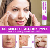 Azelaic Acid, 12% Azelaic Acid Serum Cream, Rosacea Treatment for Face, Hyaluronic Acid & Niacinamide to Relieve facial redness and minimize melasma, 0.7 Oz