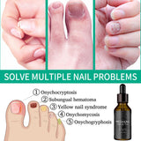 Metanail Toenail Treatment Nail Growth Treatment for Toenail Treatment Extra Strength for Repairing Damaged and Discolored Nails