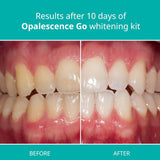 Opalescence Go - Prefilled Teeth Whitening Trays - Original 15% - (4 Treatments) - Hydrogen Peroxide with PF - Cool Mint - Made by Ultradent. 4PK-GO-15