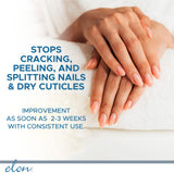 Elon Lanolin-Rich Nail Conditioner, Strengthens Nails & Protects Cuticles, Recommended by Dermatologists & Podiatrists (10g tube)