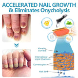 Onyxoguard Nail Growth and Repair Serum, Onyxoguard Serum, Nail Strengthener, OnycholysisHeal Nail Strengthening and Growth Conditioner, for Thin Nails And Growth (5pcs)