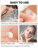 Acne Patch Pimple Patch, 4 Sizes 420 Patches Acne Absorbing Cover Patch, Hydrocolloid Invisible Acne Patches For Face Zit Patch Acne Dots Tea Tree, Calendula Oil - 3 Pack