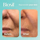 Biosil Drops - 1 fl oz, Pack of 2 - with Patented ch-OSA Complex - Increase Collagen Production for Beautiful Hair, Skin & Nails - GMO Free - 240 Total Servings, 0.28 pounds