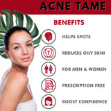 Acnetame Acne Pills- Acne Tame Supplement- Clear Skin Vitamins Pill for Oily Skin Treatment, Hormonal Blemishes, Anti Spots & Cystic Acnes Supplements for Women, Men, Teens & Adults- 60 Oral Tablets