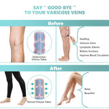 Compression Pantyhose for Women, 20-30 mmHg Footless Medical Compression Stockings, Waist High Opaque Graduated Support Compression Hose Tights for Edema, Varicose Veins, Swelling