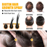 Biotin Premium Hair Growth Serum, Biotin Thickening Herbal Serum, Anti Hair Loss Nourish Dry Damaged Hair Repair,Biotin Herbal Serum for Thicker Longer & Stronger Hair,30ML (2pcs)