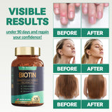 Hair Growth Vitamins for Women with Biotin10000mcg Keratin Marine Collagen Supplements Extra Strength Hair Skin and Nails Vitamins Nail & Hair Growth Supplement for Women & Men 120 Capsules