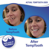 Temptooth #1 Seller Trusted Patented Temporary Tooth Replacement Product