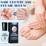 Onyxoguard Nail Growth And Repair Serum, Onyx Guard Nail, Onyxoguard Serum, Nail Strengthener For Thin Nails And Growth, Revitalize And Strengthen Your Nails