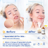 HIQILI 100ML Spearmint Essential Oil for Skin Care -100% Pure Treatment Grade - 3.38 Fl Oz.