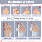 Ecqizer Bunion Corrector for Women & Men,Adjustable Knob Bunion Corrector for Women Big Toe,Bunion Splint for Bunion Relief,Orthopedic Toe Straightener Suitable for Left and Right Feet
