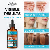 ZoeRose Liquid Biotin & Collagen Keratin Drops 60,000mcg Hair Growth Vitamins - Essential Supports Healthy Joints, Hair, Skin and Nails Vitamins - Best Liquid Collagen for Women & Men- (2Fl Oz, 60ml)